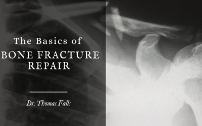 The Basics of Bone Fracture Repair