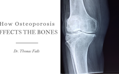 How Osteoporosis Affects the Bones